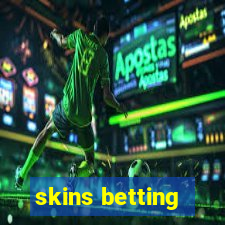 skins betting