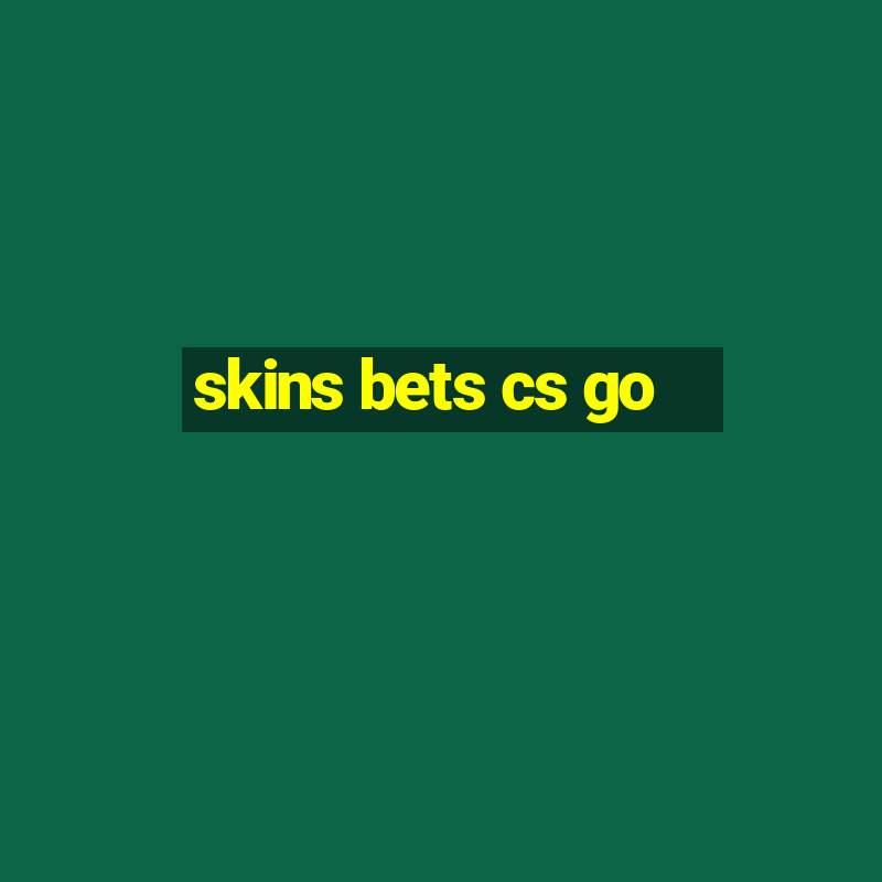 skins bets cs go