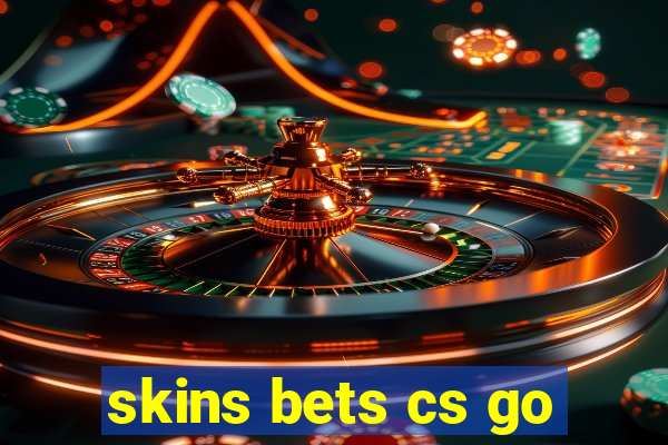 skins bets cs go