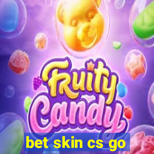 bet skin cs go