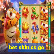 bet skin cs go