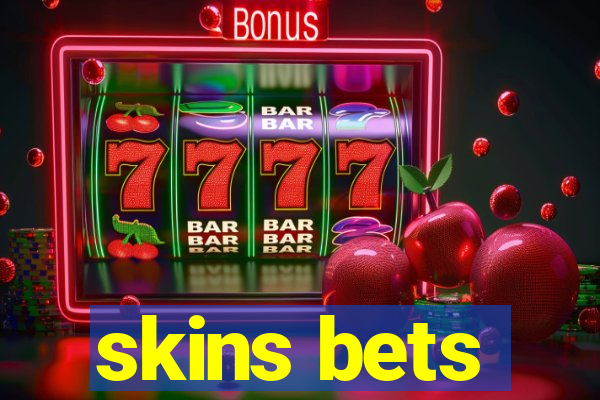 skins bets