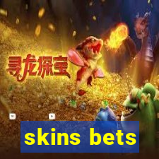 skins bets